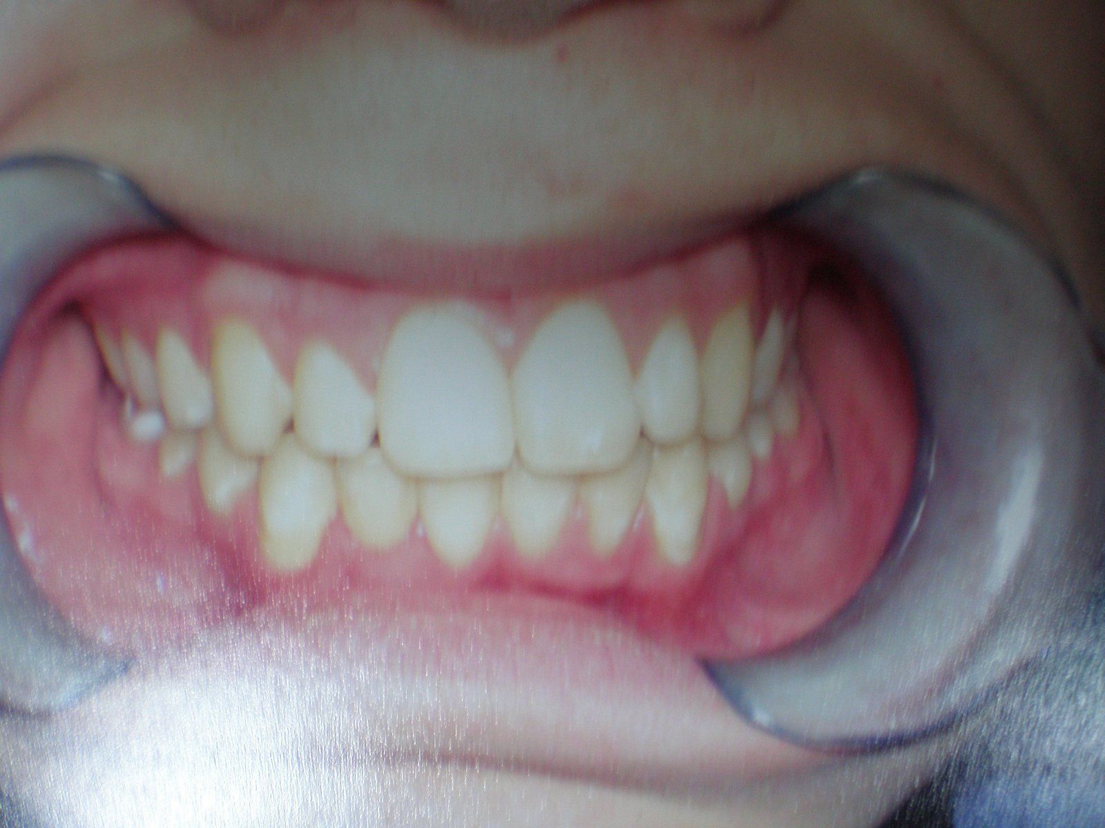 3-after