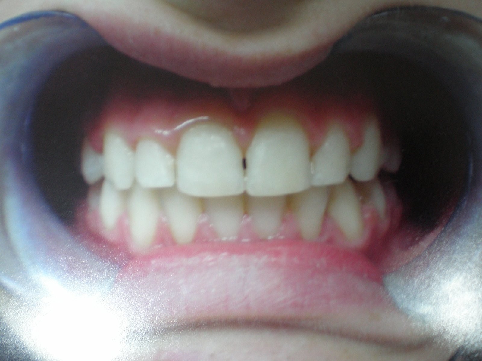 8-after